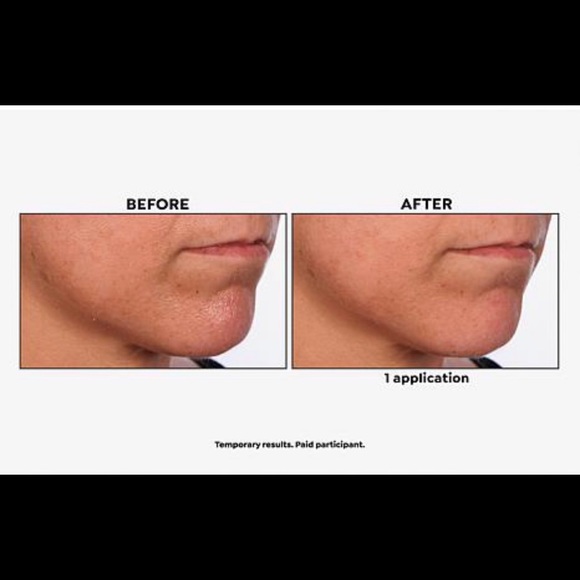 Skinn Cosmetics Non-Negotiables DermAppeal Jumbo 4 Oz. Tube, New Sealed - Picture 7 of 10